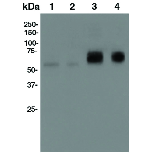 western blot